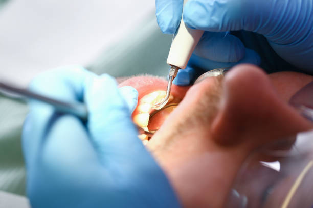 Best Emergency Dental Extractions in Morrisonville, NY