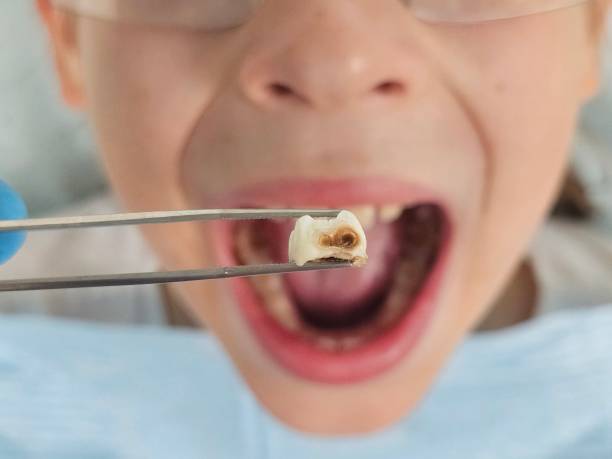 Best Emergency Dental Services for Seniors in Morrisonville, NY