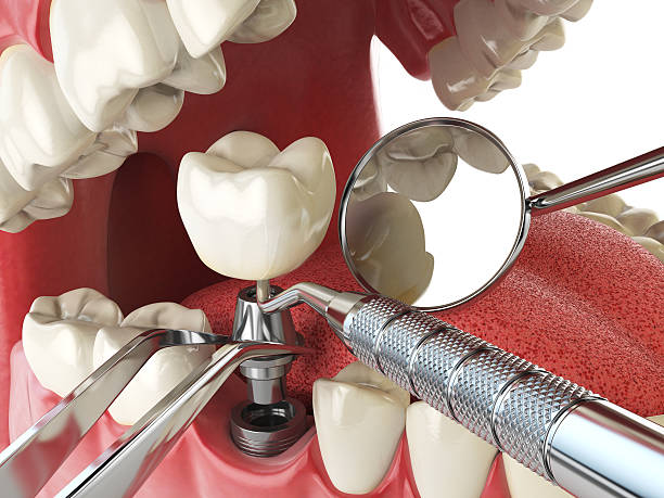 Best Emergency Dentist for Special Needs Patients in Morrisonville, NY